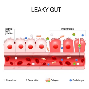 Gut Health Issues and Healing from the Inside to cure leaky gut